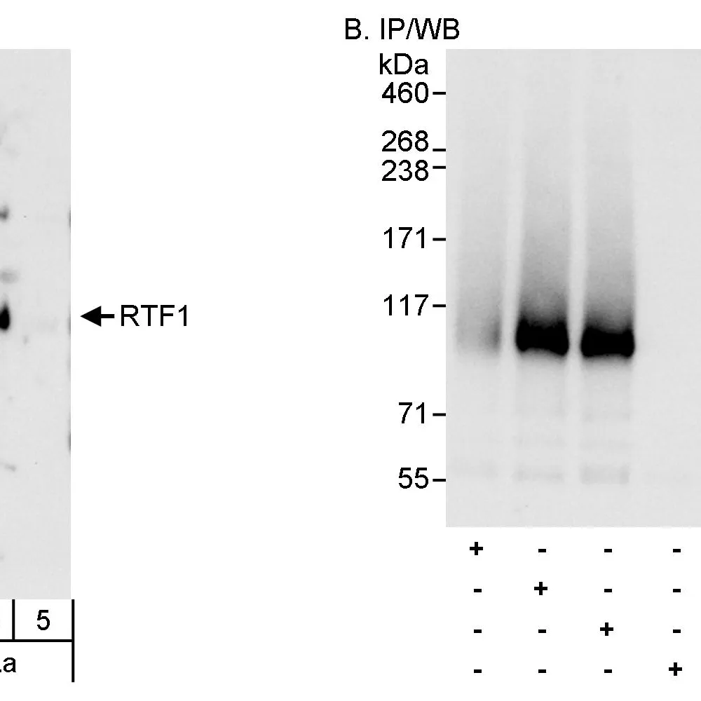 Rabbit anti-Rtf1 Antibody, Affinity Purified