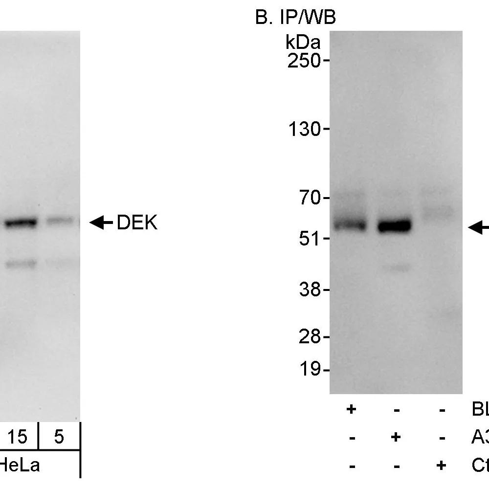 Rabbit anti-DEK Antibody, Affinity Purified