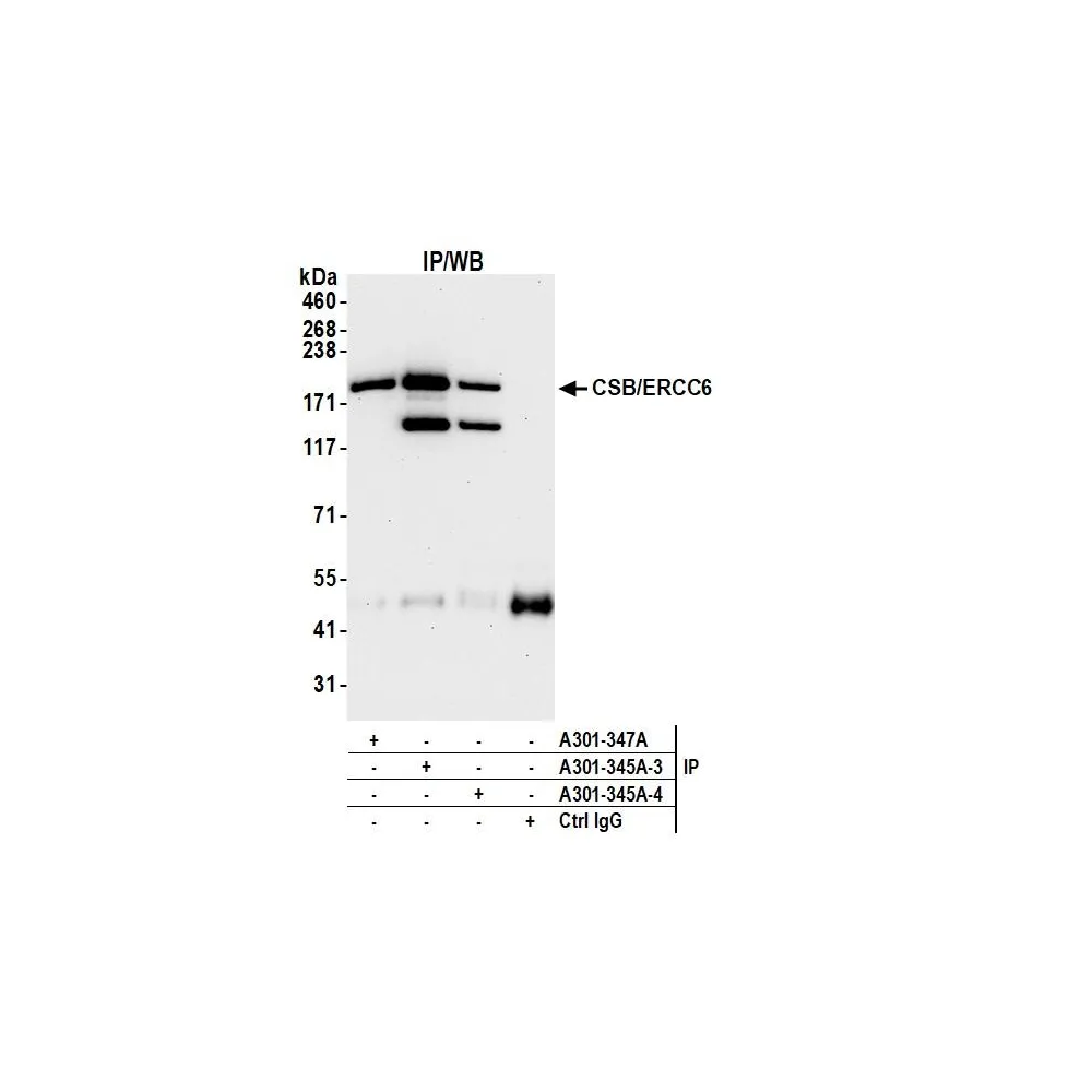 Rabbit anti-CSB/ERCC6 Antibody, Affinity Purified
