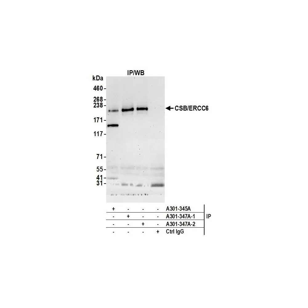 Rabbit anti-CSB/ERCC6 Antibody, Affinity Purified
