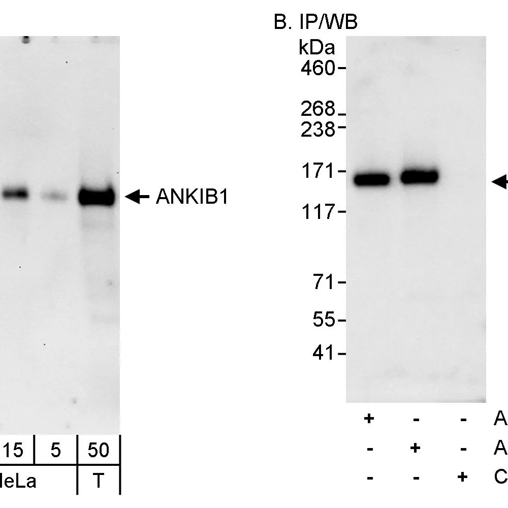 Rabbit anti-ANKIB1 Antibody, Affinity Purified