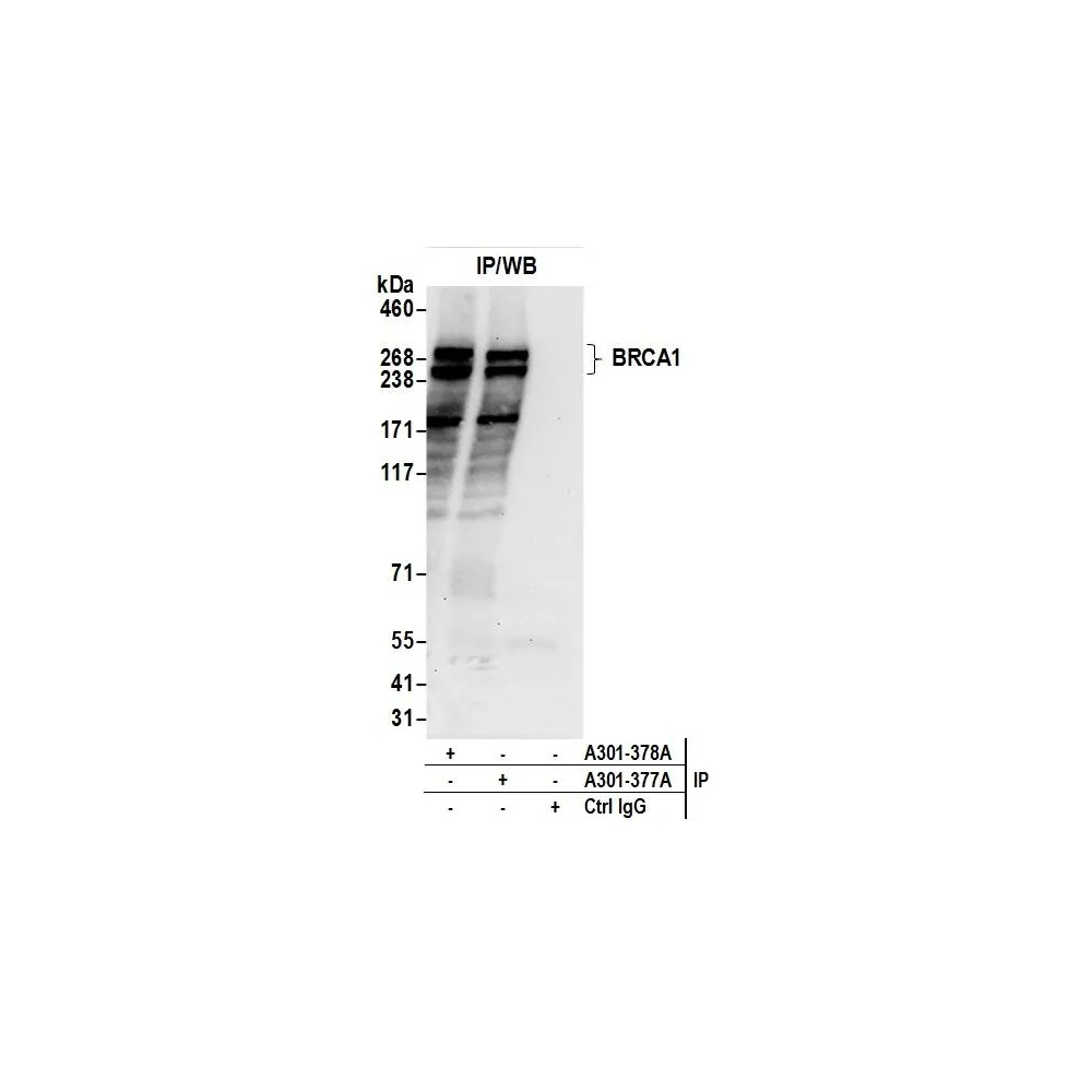 Rabbit anti-BRCA1 Antibody, Affinity Purified
