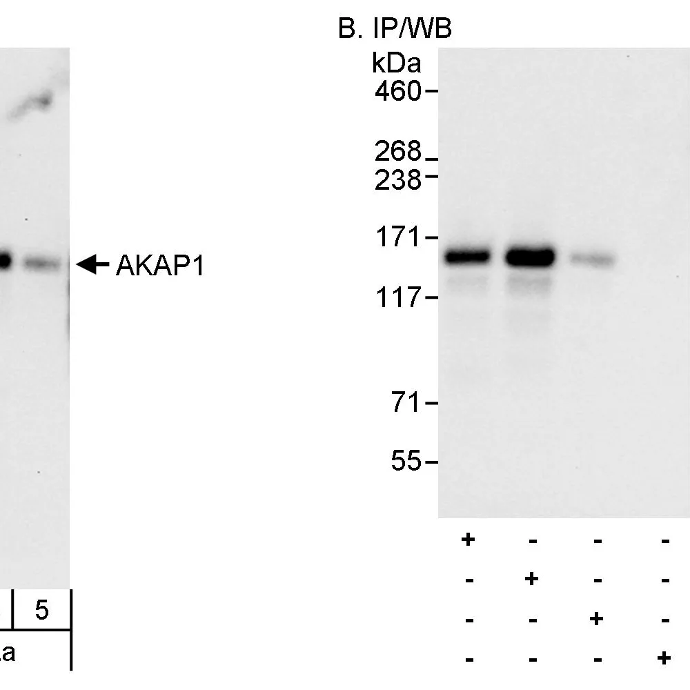 Rabbit anti-AKAP1 Antibody, Affinity Purified