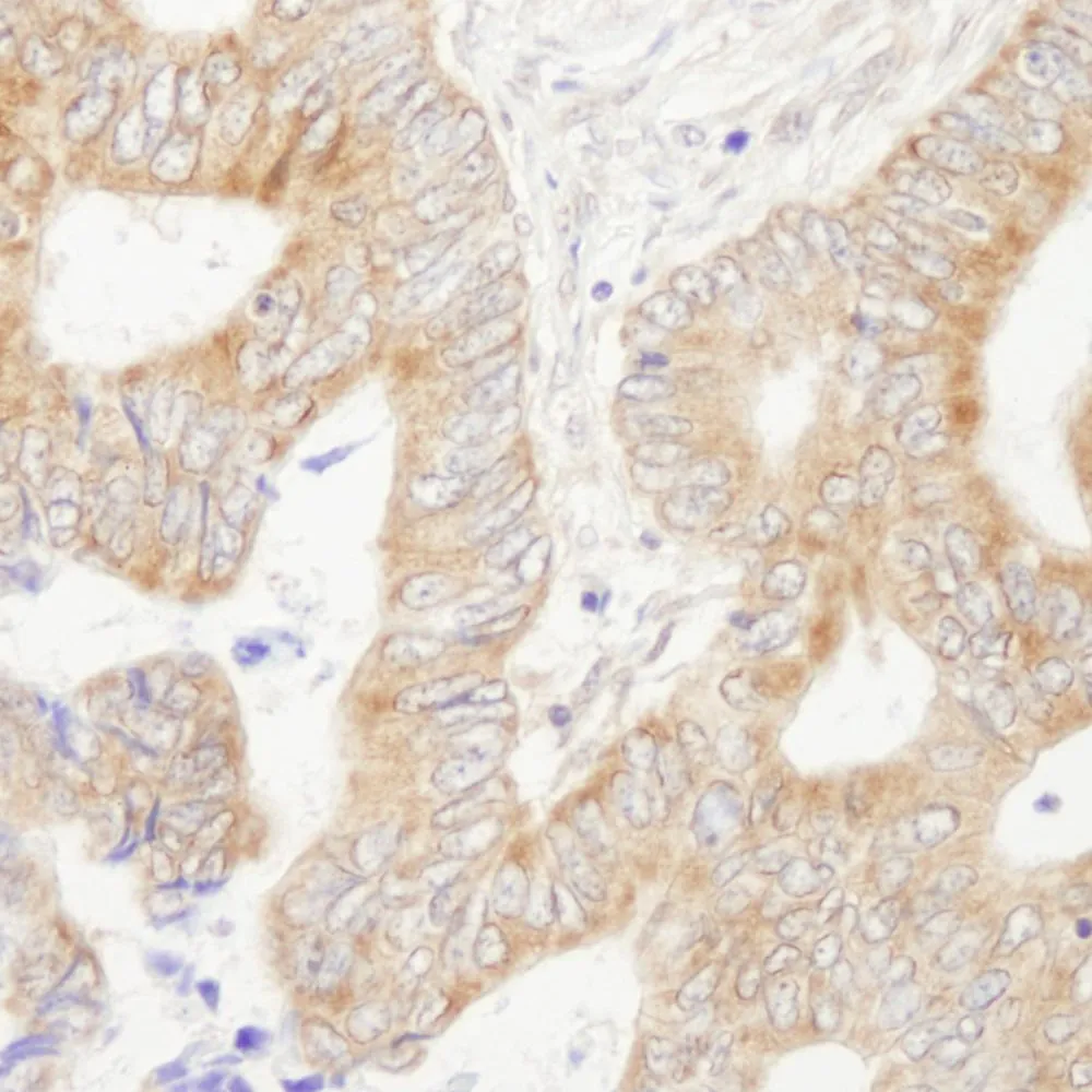 Rabbit anti-AKAP1 Antibody, Affinity Purified