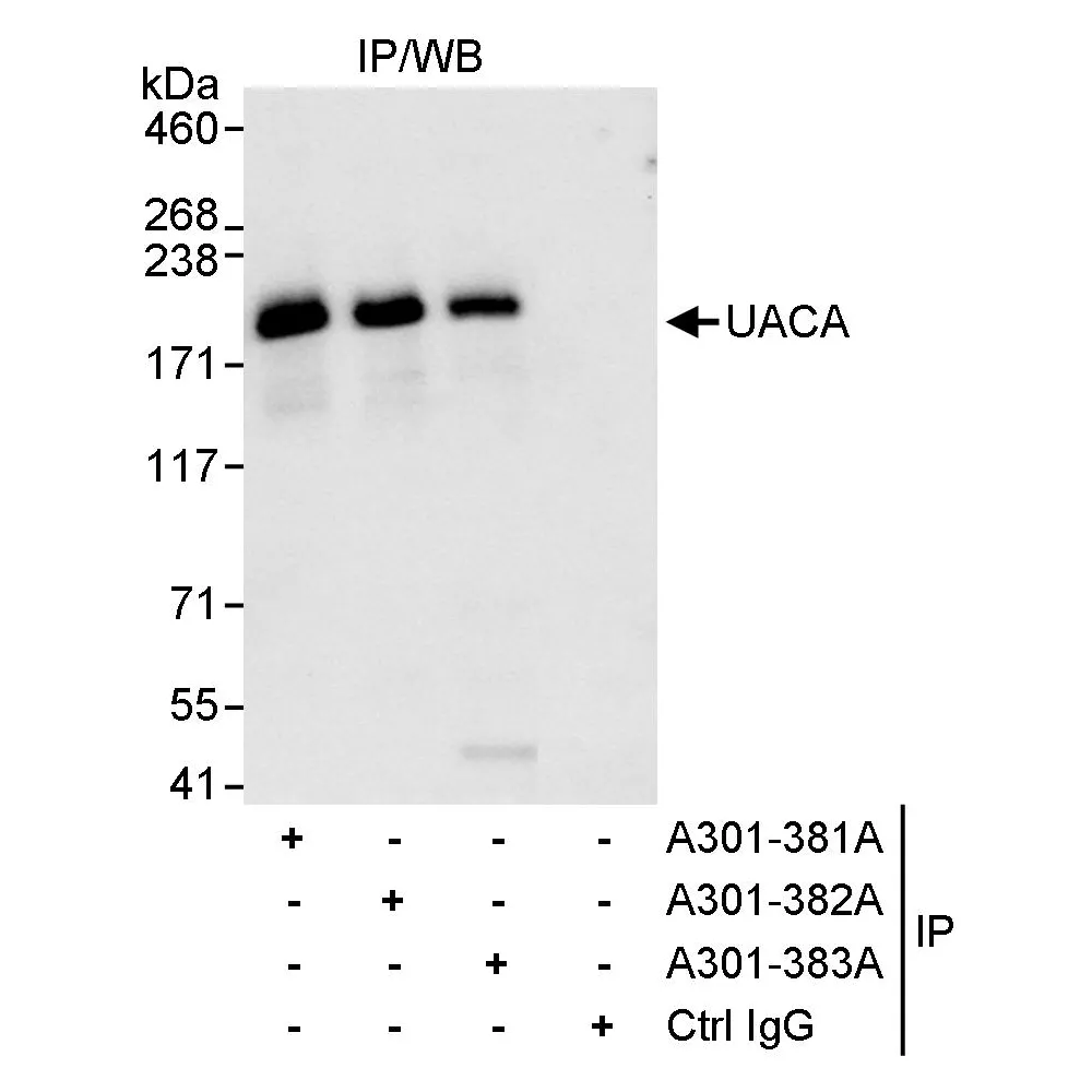 Rabbit anti-UACA Antibody, Affinity Purified