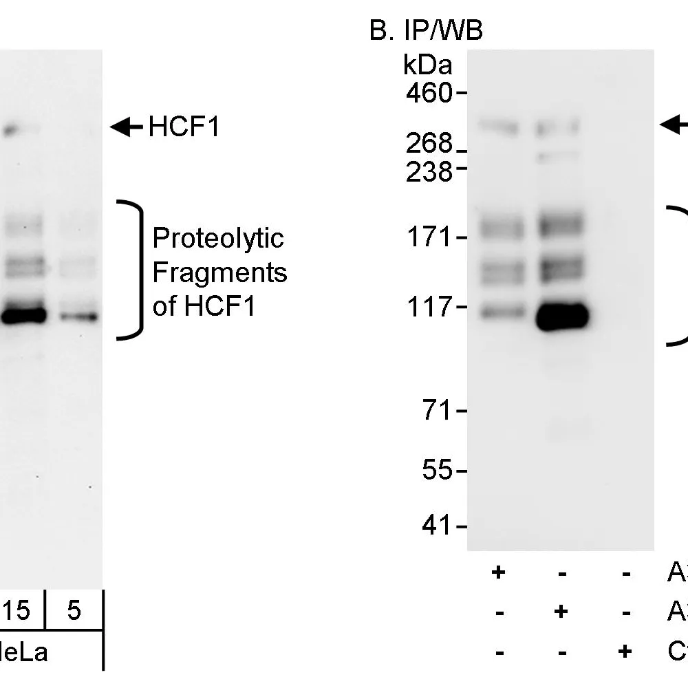 Rabbit anti-HCF1 Antibody, Affinity Purified