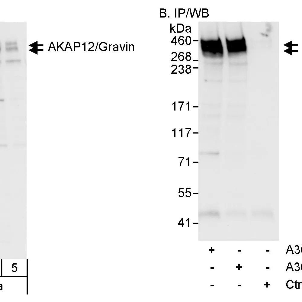 Rabbit anti-AKAP12/Gravin Antibody, Affinity Purified