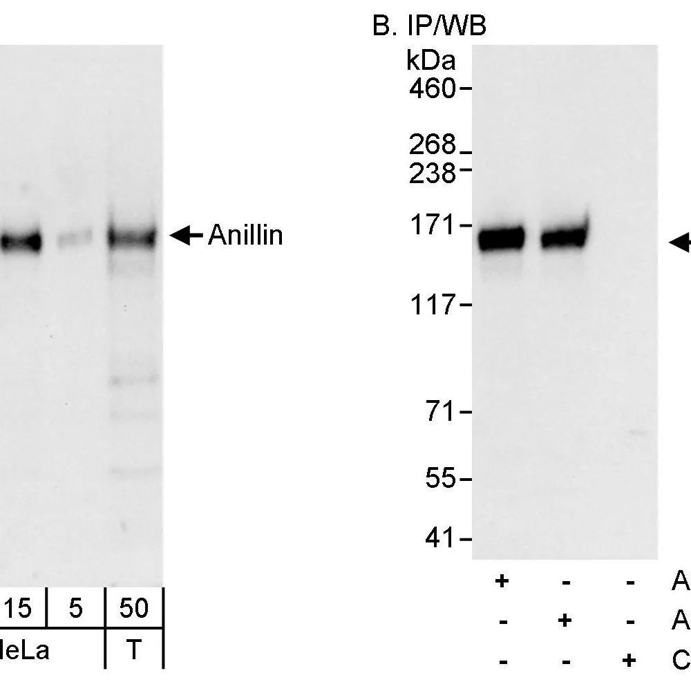 Rabbit anti-Anillin Antibody, Affinity Purified