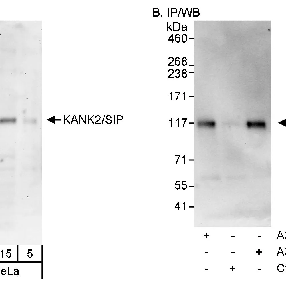 Rabbit anti-KANK2/SIP Antibody, Affinity Purified