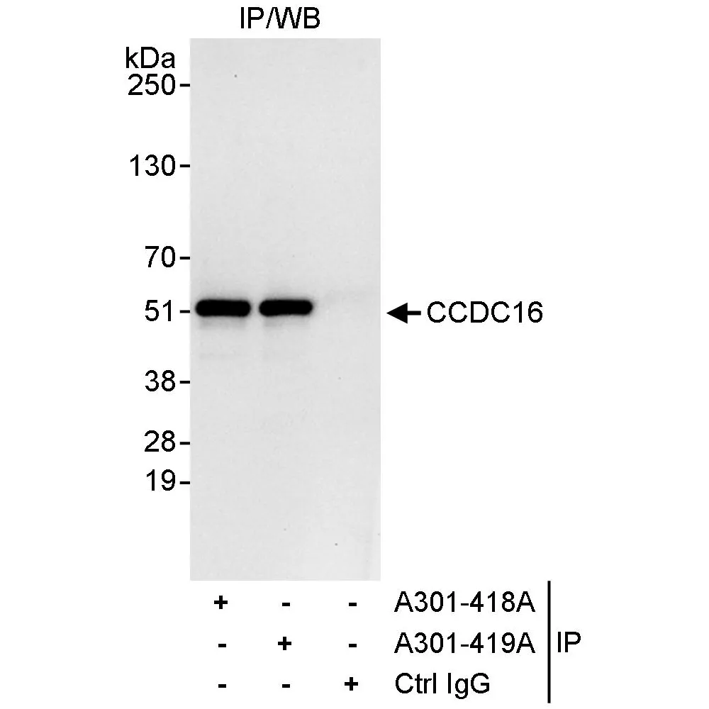 Rabbit anti-CCDC16 Antibody, Affinity Purified