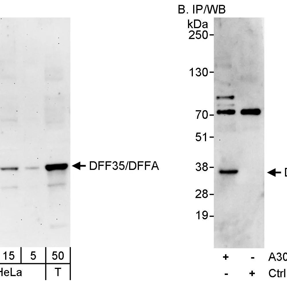 Rabbit anti-DFF35/DFFA Antibody, Affinity Purified