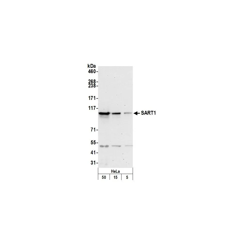 Rabbit anti-SART1 Antibody, Affinity Purified