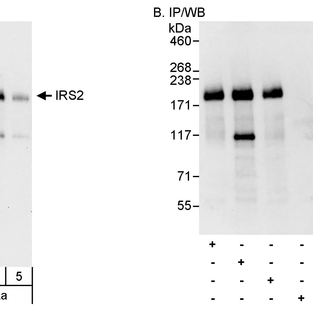 Rabbit anti-IRS2 Antibody, Affinity Purified