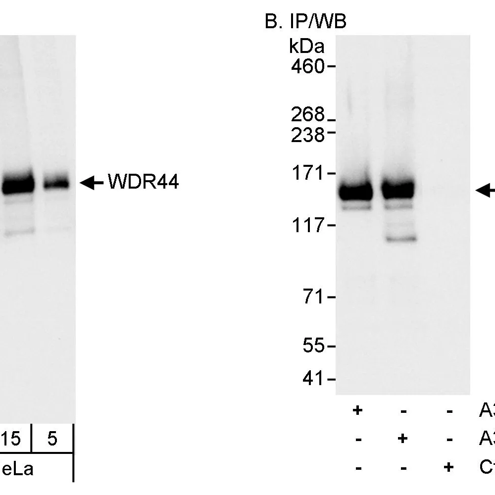 Rabbit anti-WDR44 Antibody, Affinity Purified