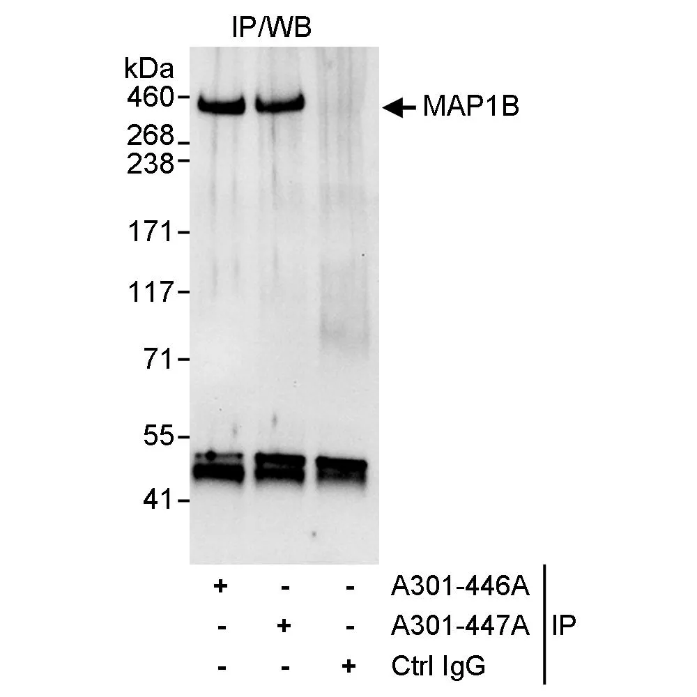 Rabbit anti-MAP1B Antibody, Affinity Purified