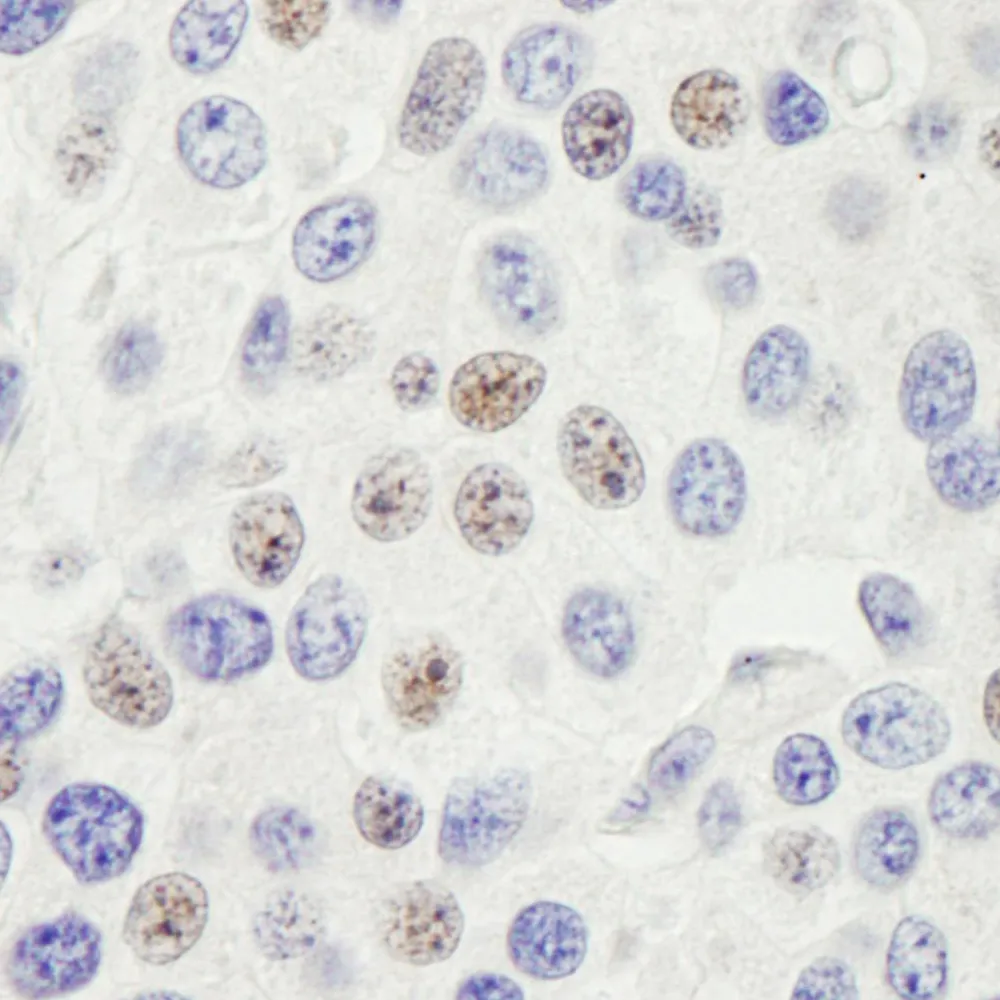 Rabbit anti-PHF6 Antibody, Affinity Purified