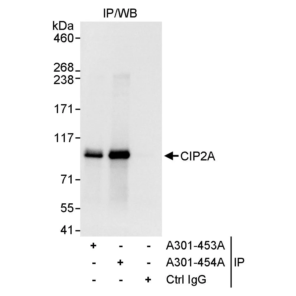 Rabbit anti-CIP2A Antibody, Affinity Purified