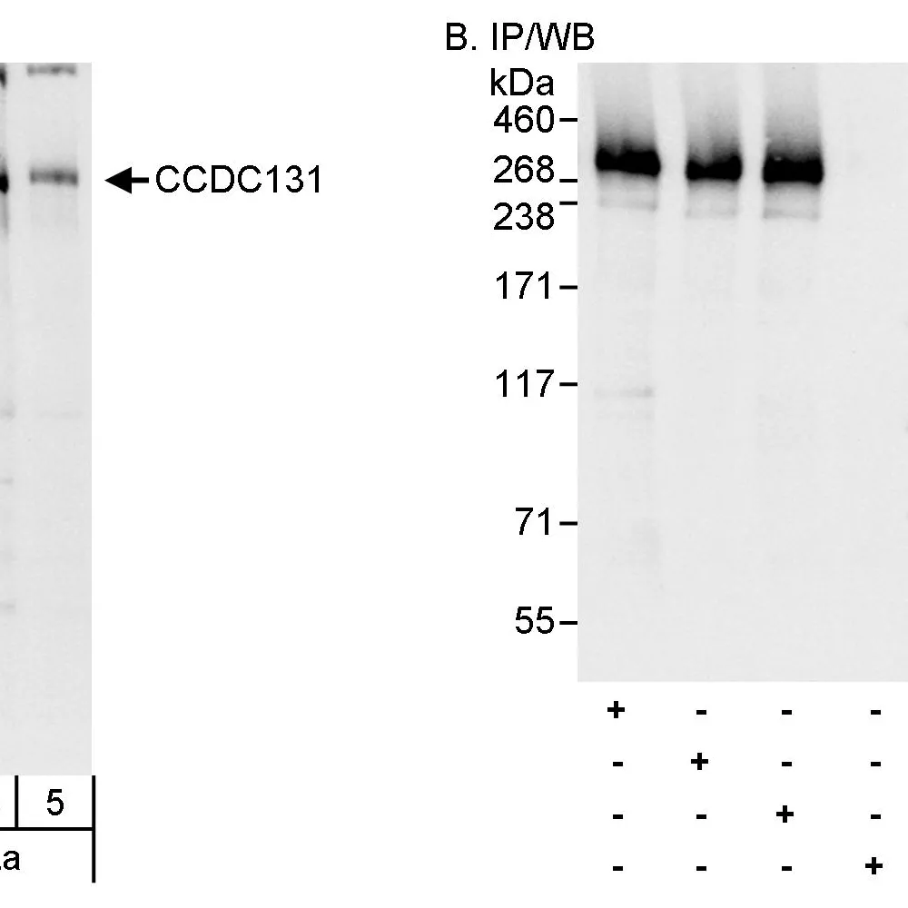 Rabbit anti-CCDC131 Antibody, Affinity Purified
