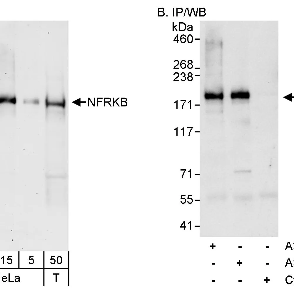 Rabbit anti-NFRKB Antibody, Affinity Purified