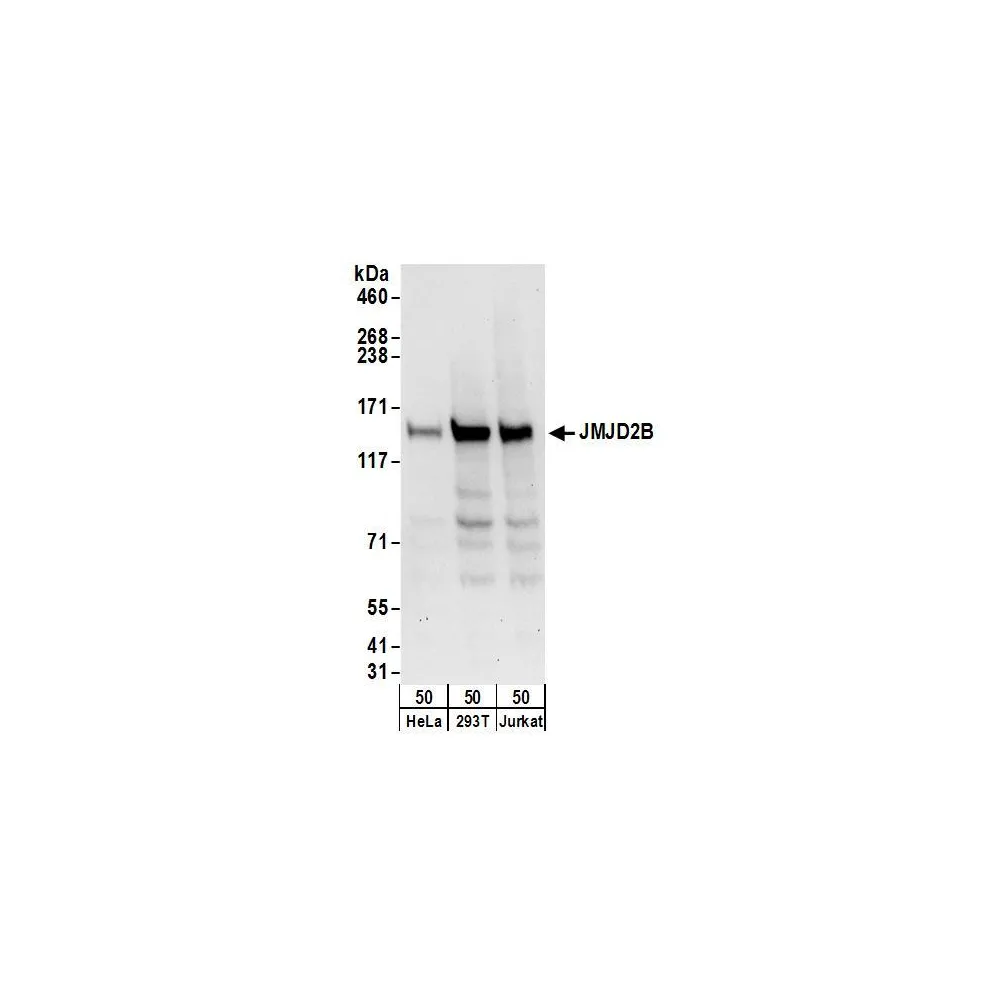 Rabbit anti-JMJD2B Antibody, Affinity Purified