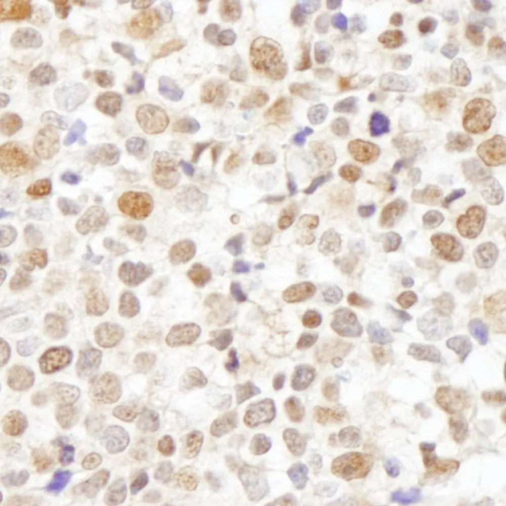 Rabbit anti-Caf1p150 Antibody, Affinity Purified