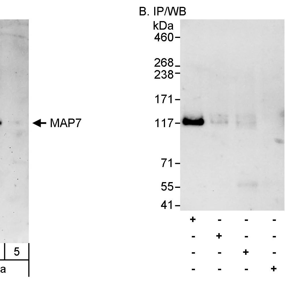 Rabbit anti-MAP7 Antibody, Affinity Purified