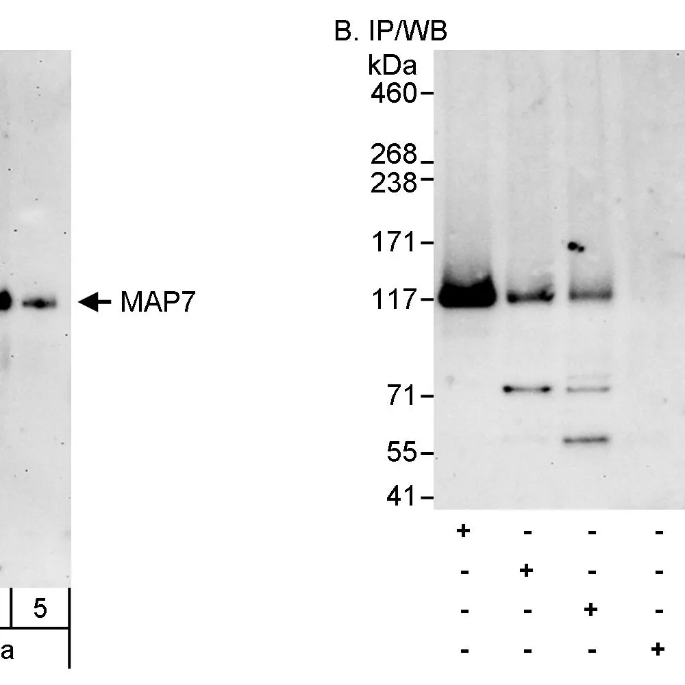 Rabbit anti-MAP7 Antibody, Affinity Purified