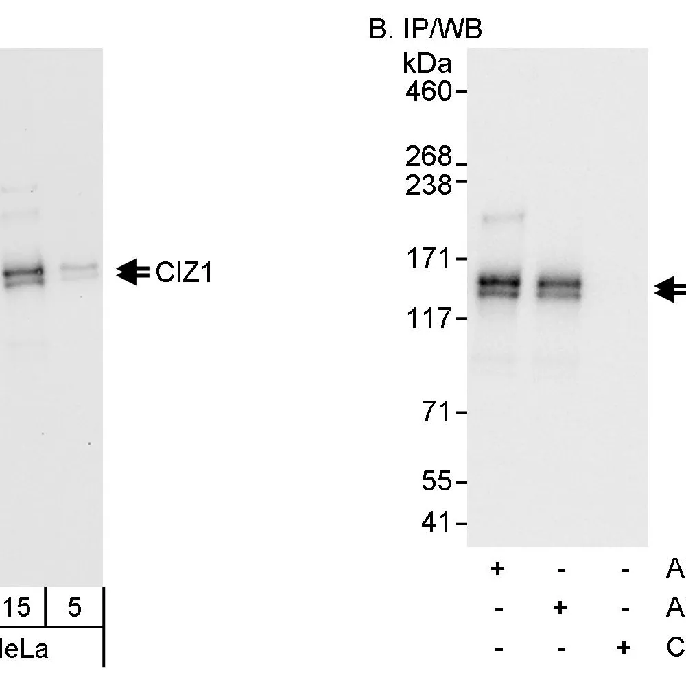Rabbit anti-CIZ1 Antibody, Affinity Purified