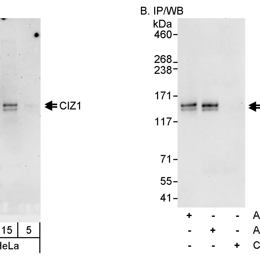 Rabbit anti-CIZ1 Antibody, Affinity Purified
