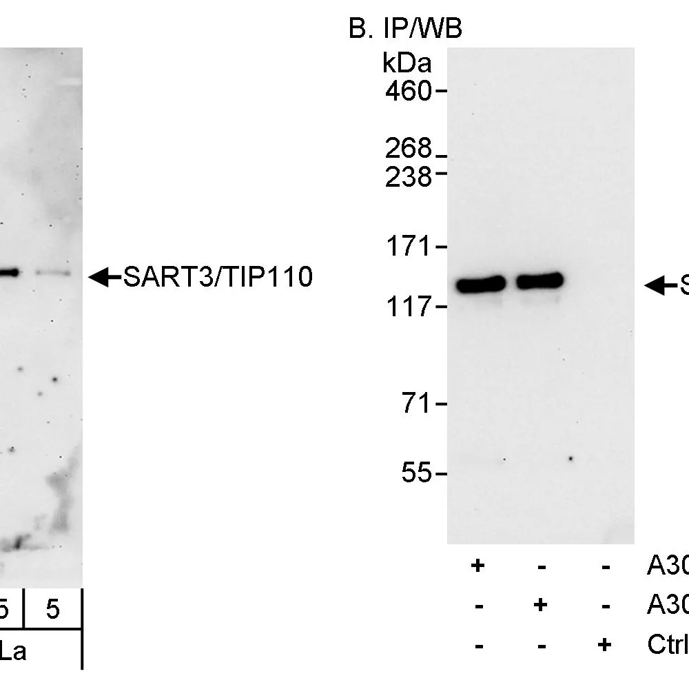 Rabbit anti-SART3/TIP110 Antibody, Affinity Purified