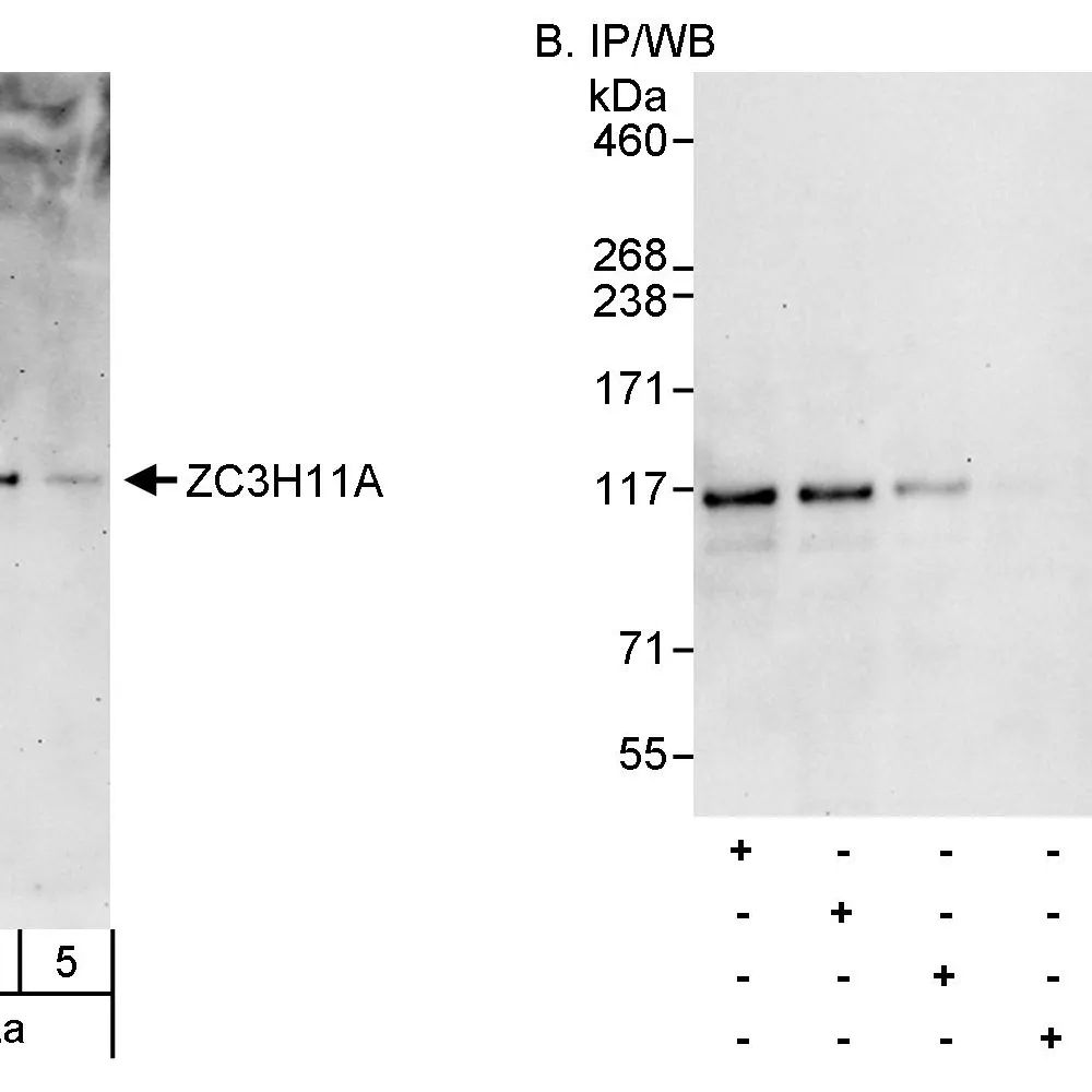 Rabbit anti-ZC3H11A Antibody, Affinity Purified