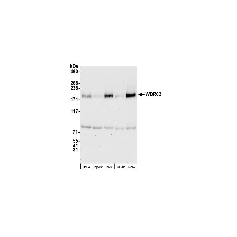 Rabbit anti-WDR62 Antibody, Affinity Purified