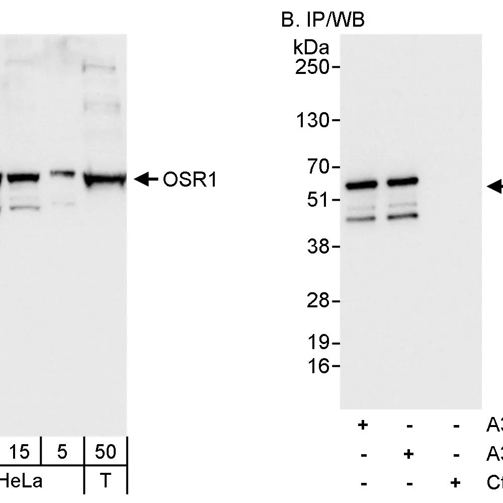Rabbit anti-OSR1 Antibody, Affinity Purified