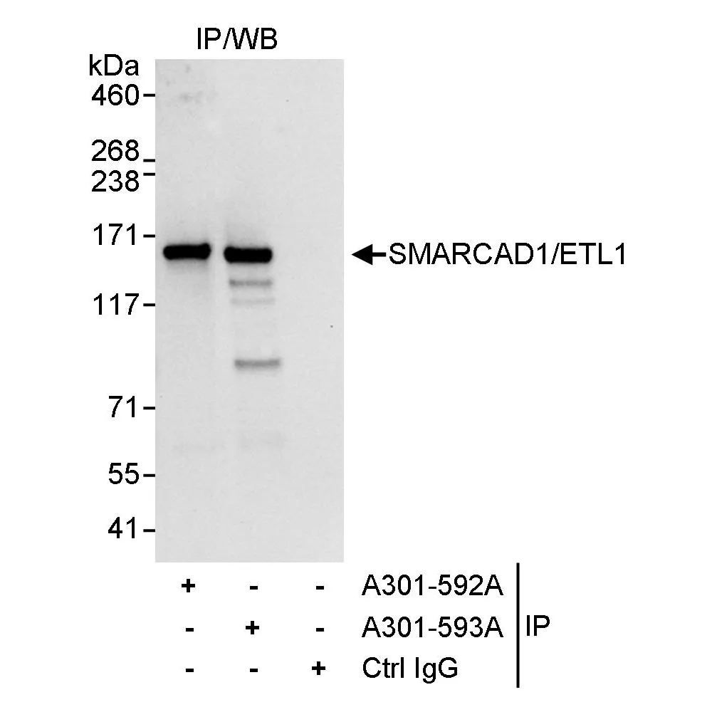 Rabbit anti-SMARCAD1/ETL1 Antibody, Affinity Purified