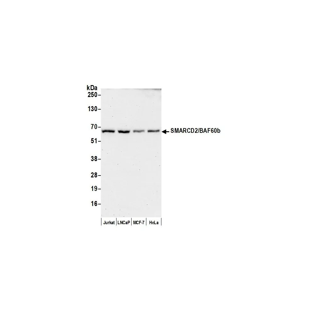 Rabbit anti-SMARCD2/BAF60b Antibody, Affinity Purified