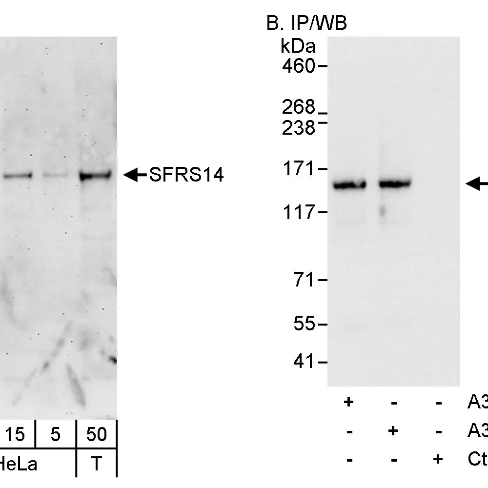 Rabbit anti-SFRS14 Antibody, Affinity Purified