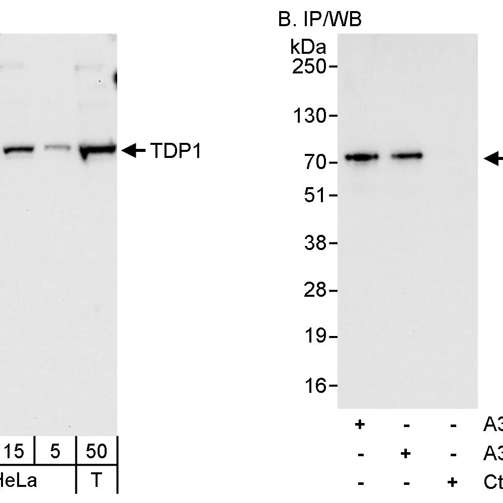Rabbit anti-TDP1 Antibody, Affinity Purified
