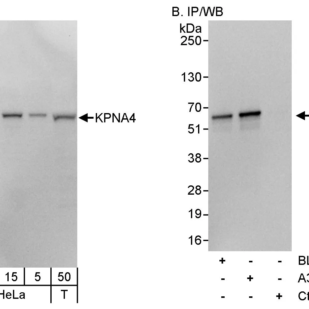 Rabbit anti-KPNA4 Antibody, Affinity Purified