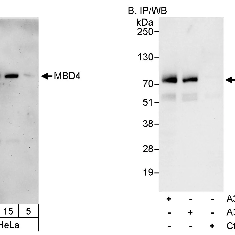 Rabbit anti-MBD4 Antibody, Affinity Purified