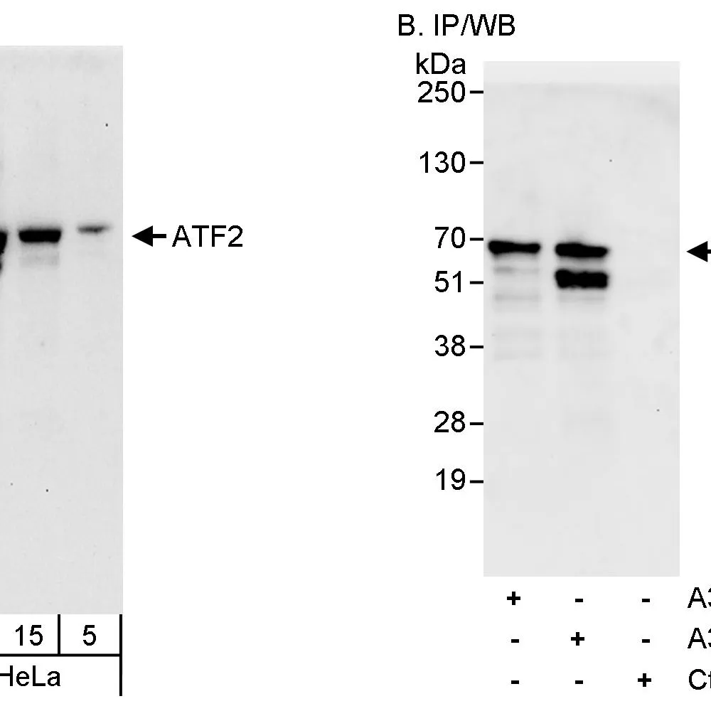 Rabbit anti-ATF2 Antibody, Affinity Purified