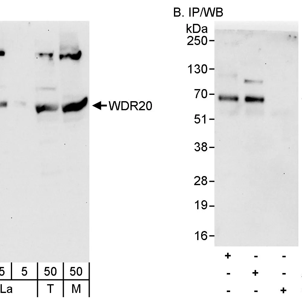Rabbit anti-WDR20 Antibody, Affinity Purified