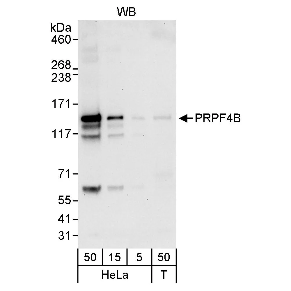 Rabbit anti-PRPF4B Antibody, Affinity Purified