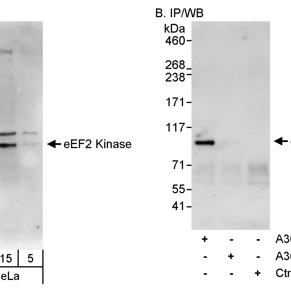 Rabbit anti-eEF2 Kinase Antibody, Affinity Purified