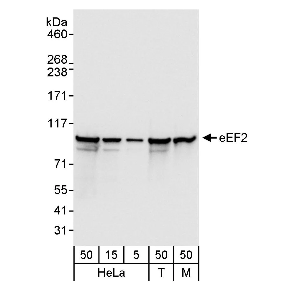 Rabbit anti-eEF2 Antibody, Affinity Purified