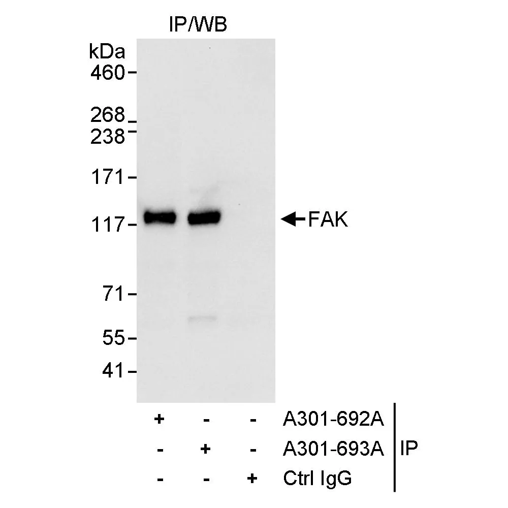 Rabbit anti-FAK Antibody, Affinity Purified