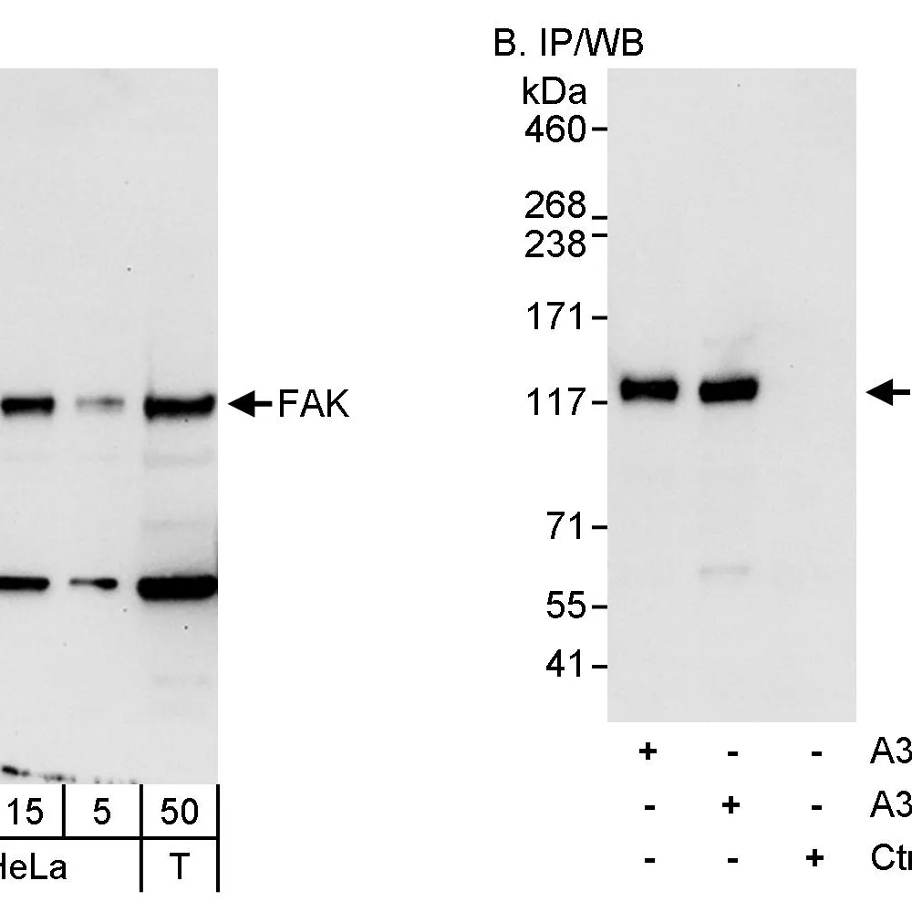 Rabbit anti-FAK Antibody, Affinity Purified