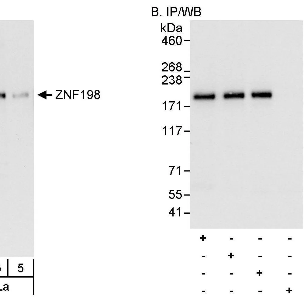 Rabbit anti-ZNF198 Antibody, Affinity Purified