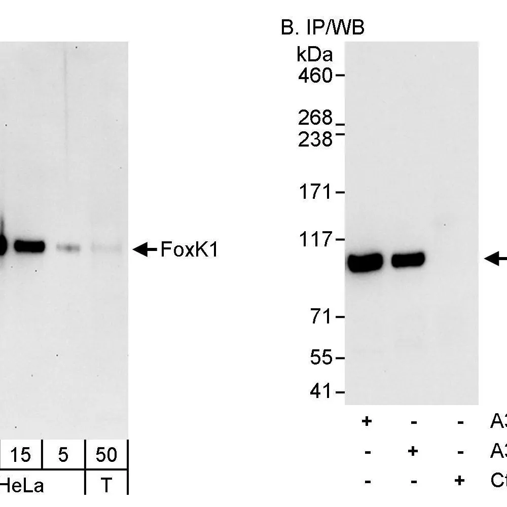 Rabbit anti-FOXK1 Antibody, Affinity Purified