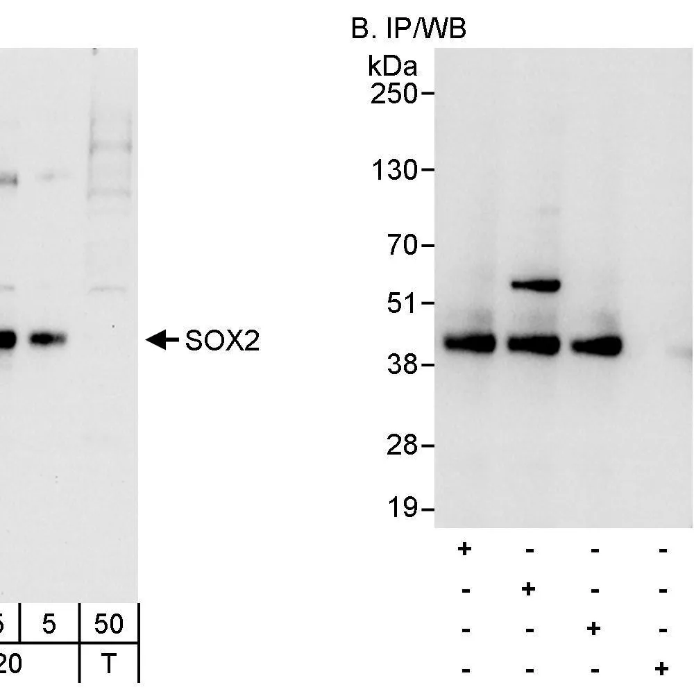 Rabbit anti-SOX2 Antibody, Affinity Purified