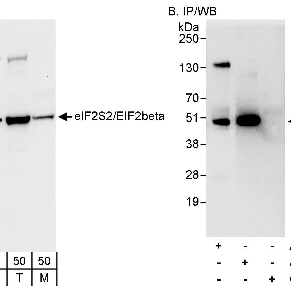 Rabbit anti-eIF2beta/EIF2S2 Antibody, Affinity Purified